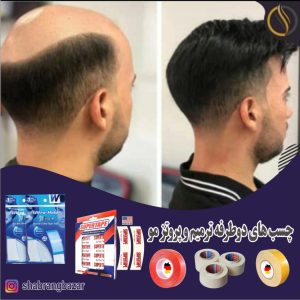 چسب پروتز و ترمیم مو برند پرفورمنس30عددی بدون شیره